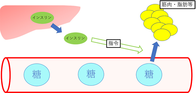 妊娠糖尿病-図1