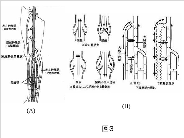 下肢難治性潰瘍_図3