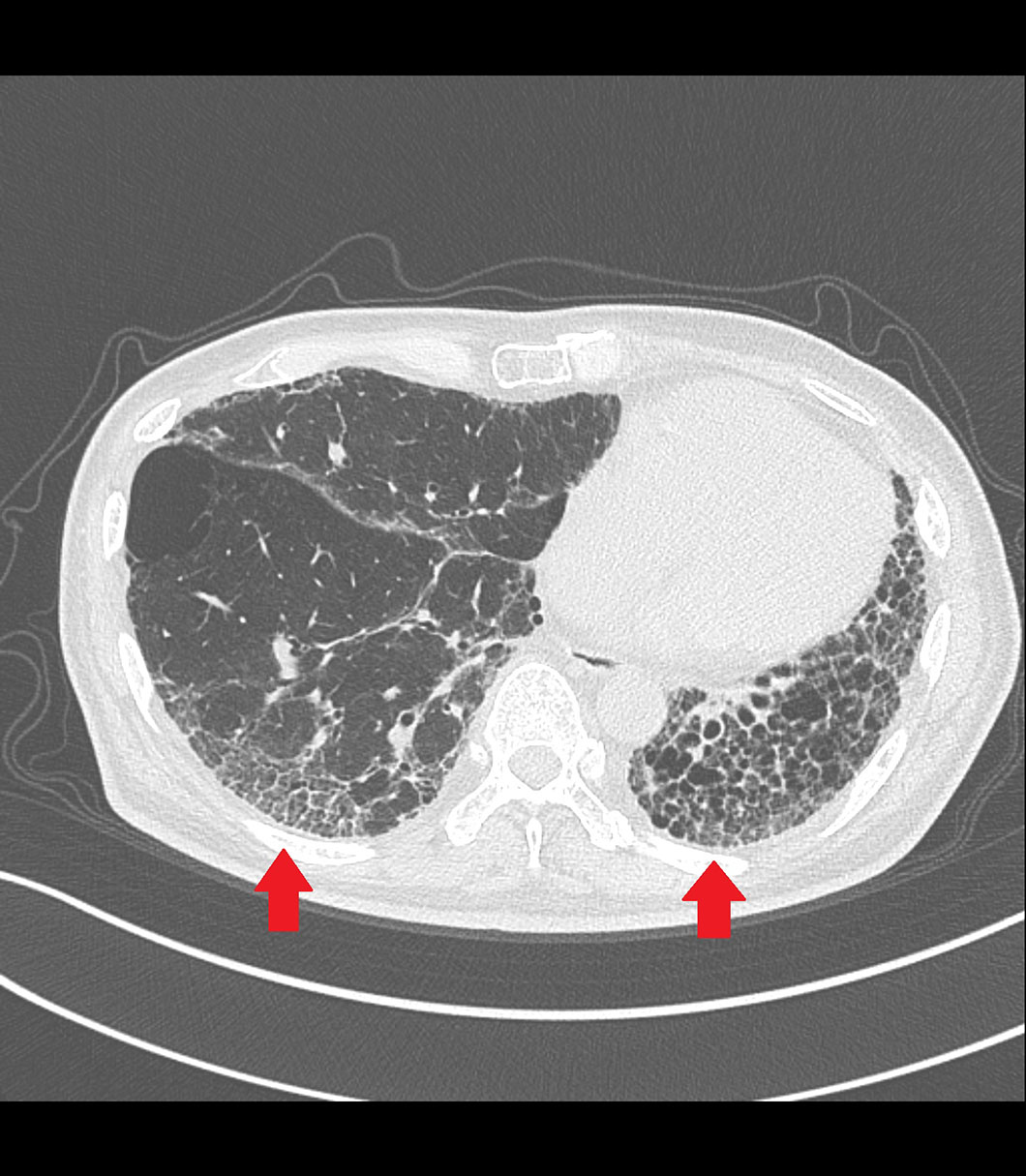 CT IP axi marked