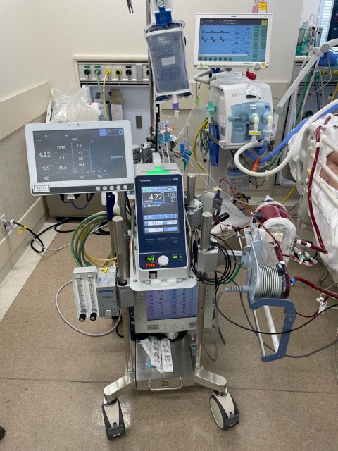 ECMO（エクモ）