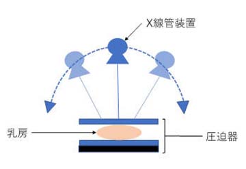 トモシンセシスとは_03