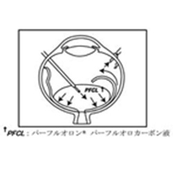 パーフルオロン(眼科手術用材料)