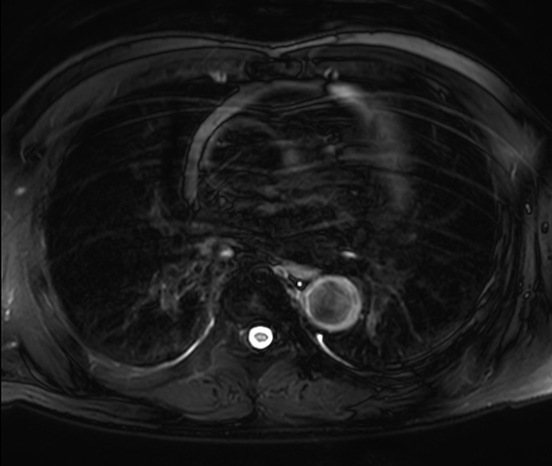 図16. MRI／MRA像