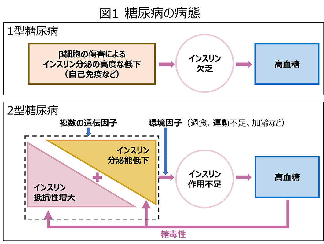 糖尿病解説図1