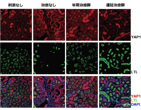 図3　化合物3kは線維化誘導後のYAP1発現を抑制し尿細管萎縮を改善する