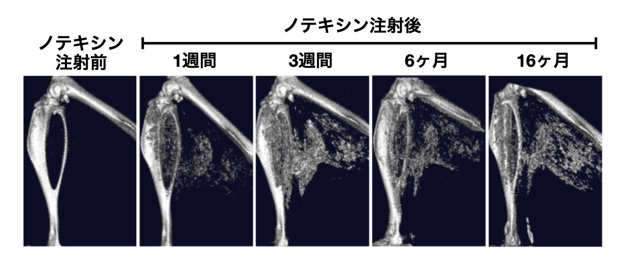石灰化筋壊死症を再現する新規マウスモデルを確立 〜ヘビ毒を用いて、外傷後に長期残存する筋石灰化を再現〜