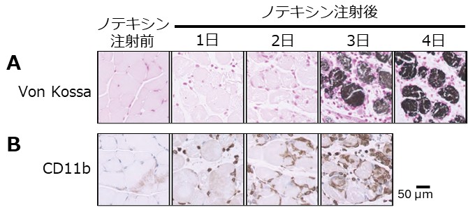 図3. 筋組織の石灰化と炎症反応