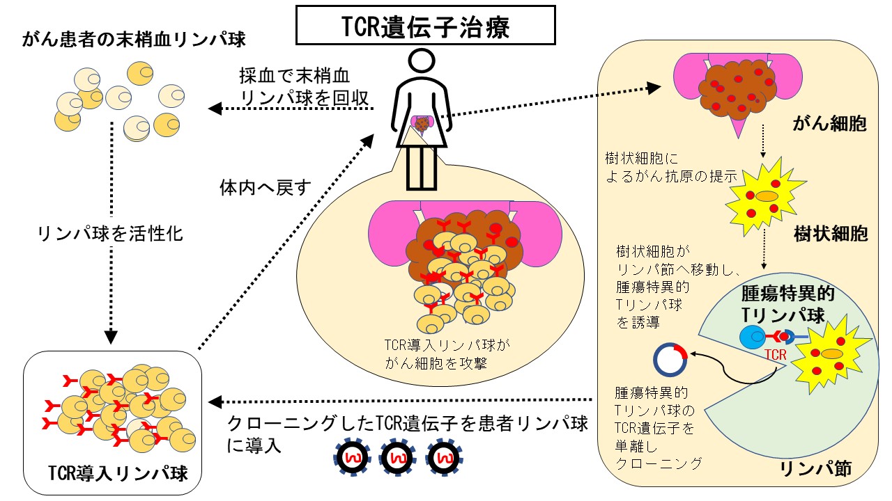 TCR遺伝子治療